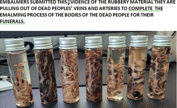 ORGANISMS EMBALLERS REMOVED FROM ARTERIES AND VEINS OF THE DECEASED